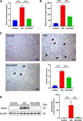 Huangqi-Danshen decoction protects against cisplatin-induced acute kidney injury in mice